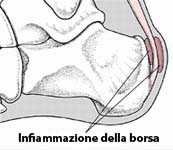 Podologo a Jesi (Ancona) e Cingoli (Macerata)