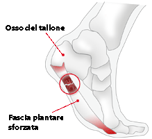 Podologo a Jesi (Ancona) e Cingoli (Macerata)