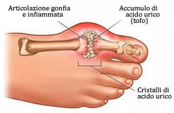 Podologo a Jesi (Ancona) e Cingoli (Macerata)