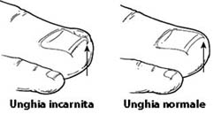 Podologo a Jesi (Ancona) e Cingoli (Macerata)